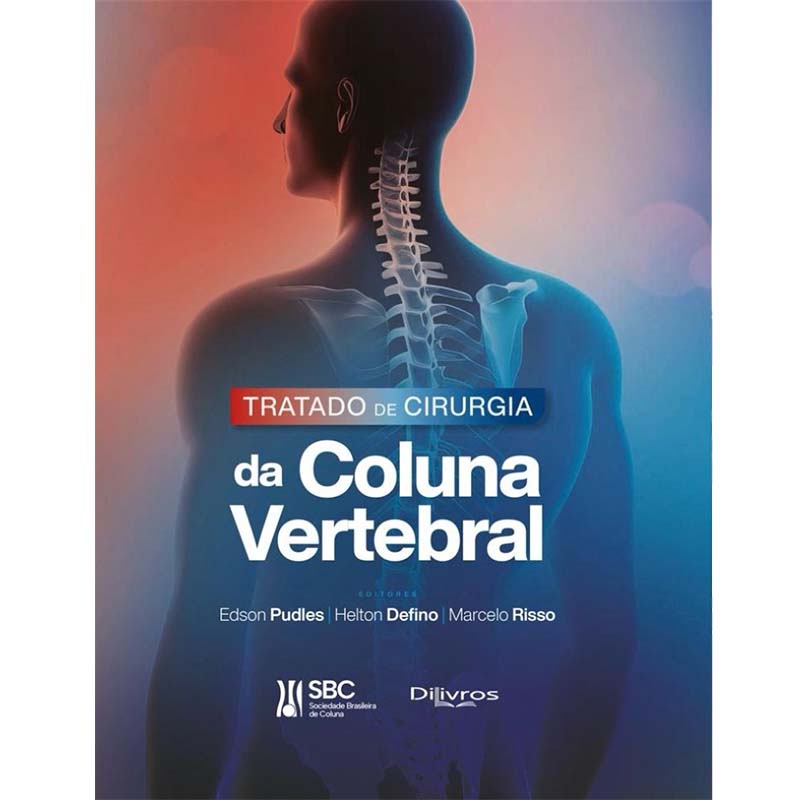 dr robert meves livro cirurgia coluna vertebral 800x800 01